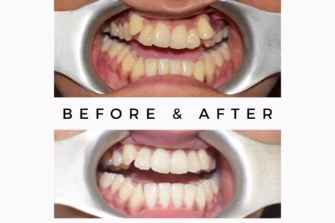 cosmetic-dentistry-brampton