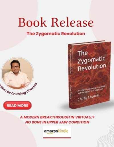 The Zygomatic Revolution